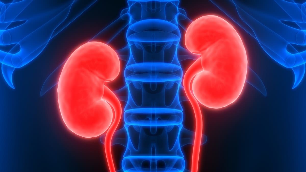 kidney-cancer